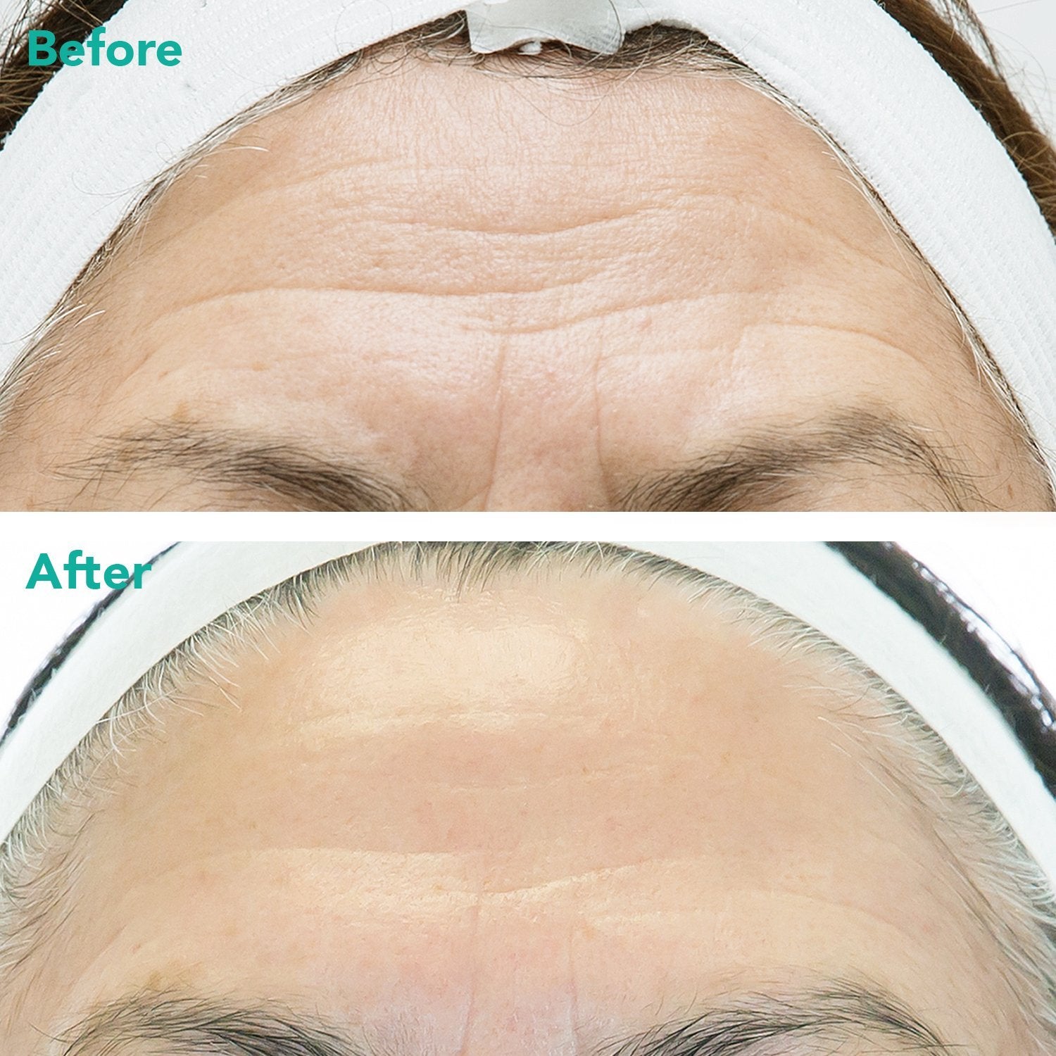 Anti-aging Retinol Serum