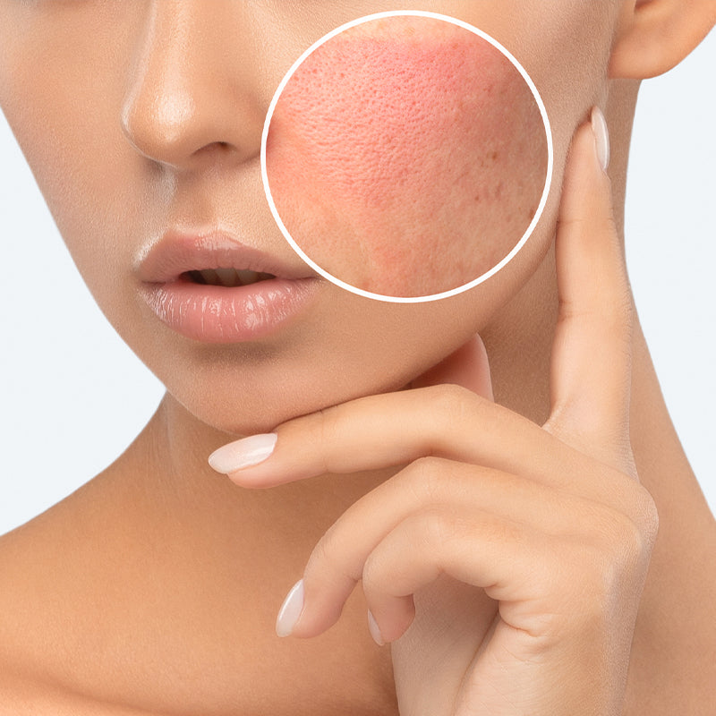 Reveal Your Best Skin Yet with the Benefits of Lactic Acid