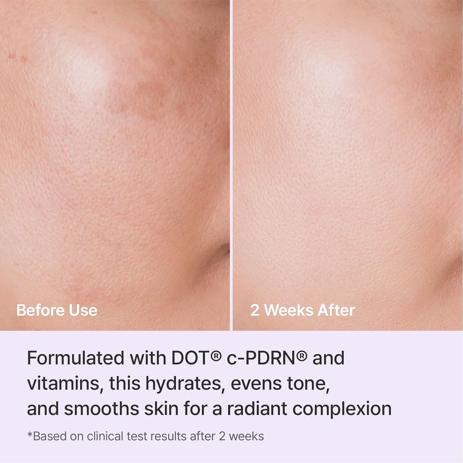 Triple Radiance Cream