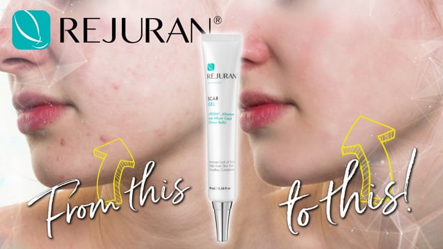 Advanced Scar Gel Video