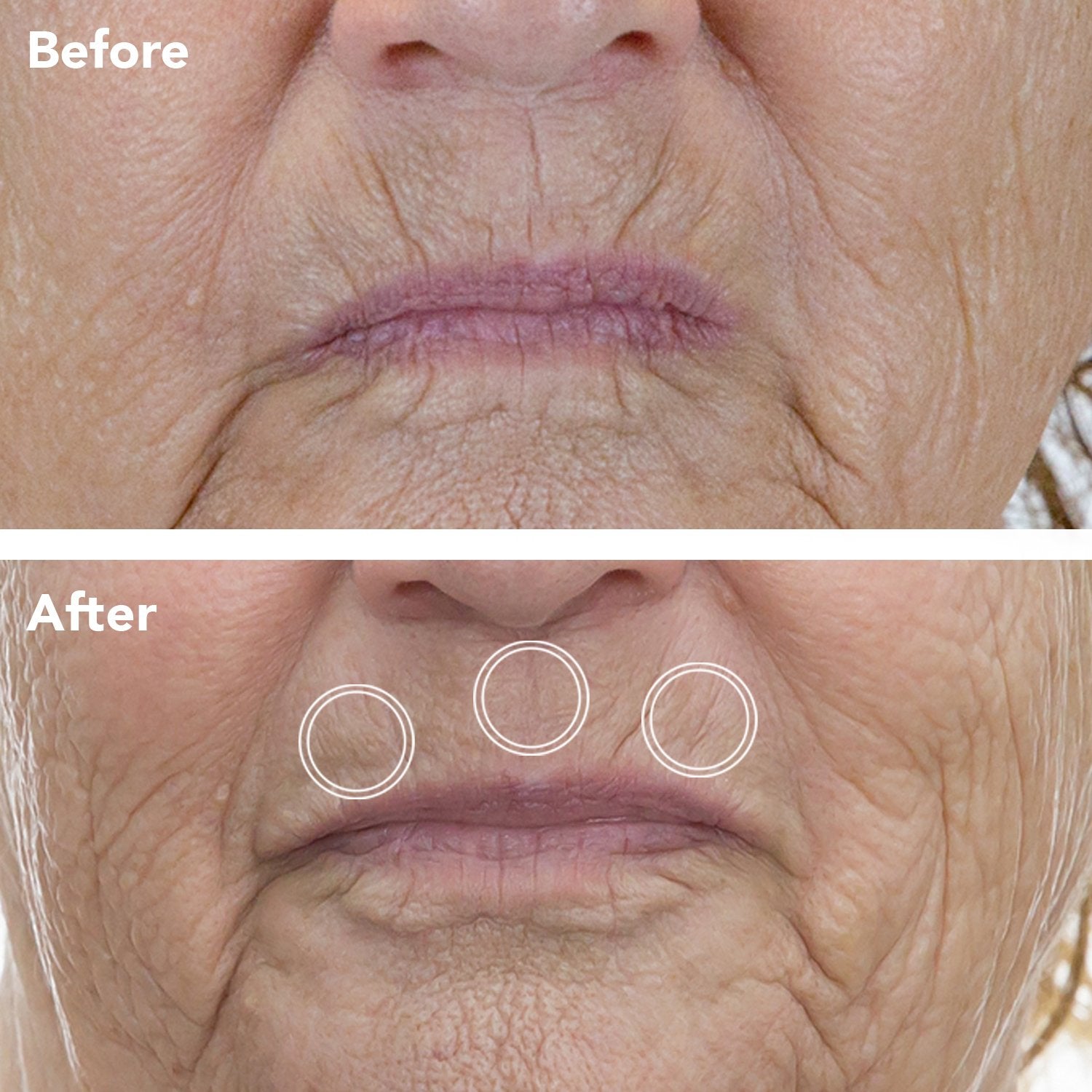Anti-aging Retinol Serum Before And After Photo